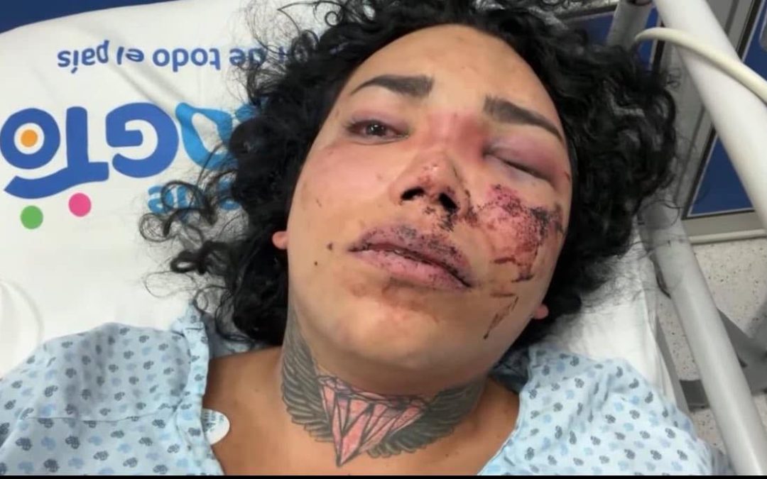 Paola Suárez es golpeada brutalmente por su pareja